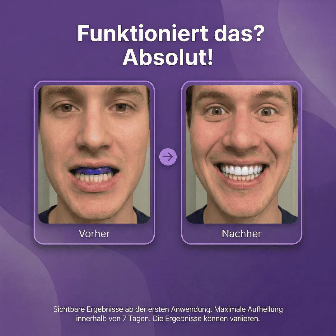 Vioren - Lila Zahnweiß-Streifen